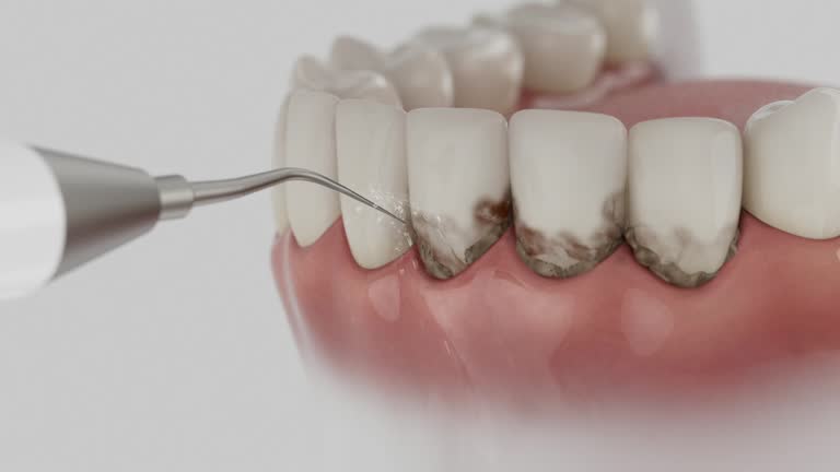 Reliable Dental Implants contractor in Baxley, GA by Smile Center Dentistry